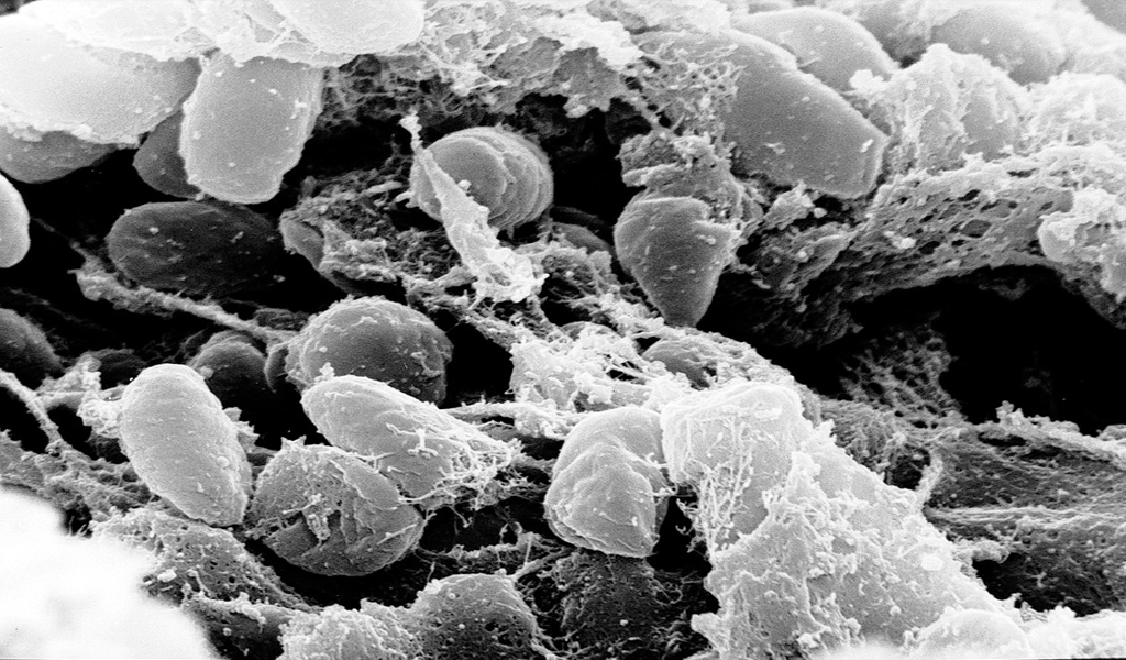 Plague Outbreak in Africa is an Engineered Depopulation Bioweapon, says African Scientist